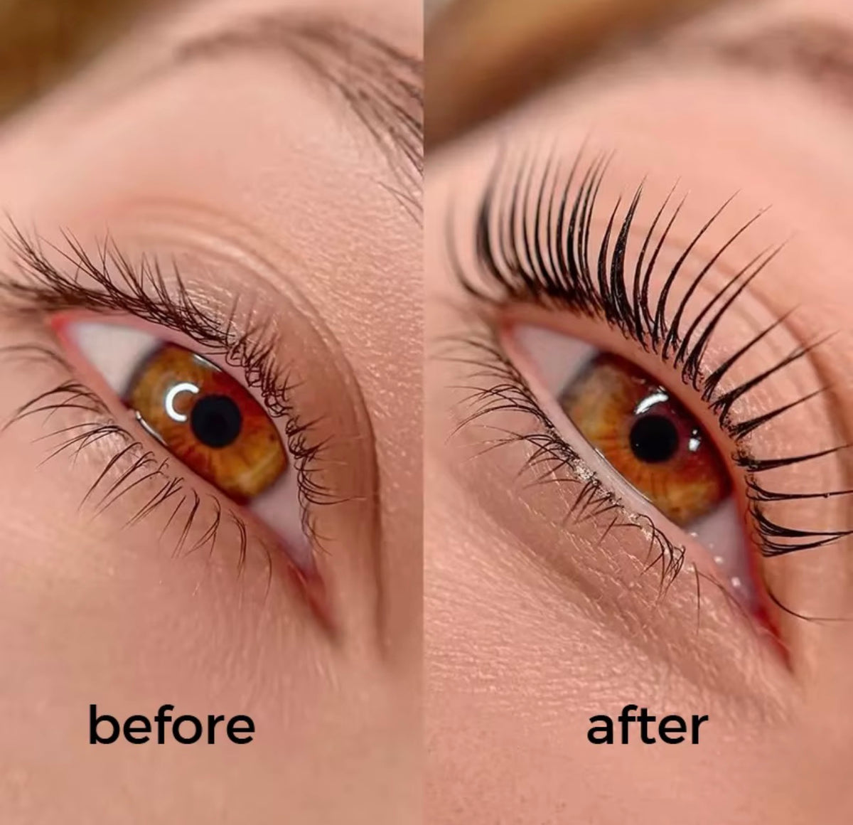 LIFT KIT inspirer KOREA pour un regard sublimé